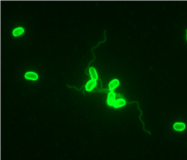 IFAT Microsporidia